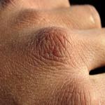 Custom Cosmetic Label Tips to Promote Winter Skin Care